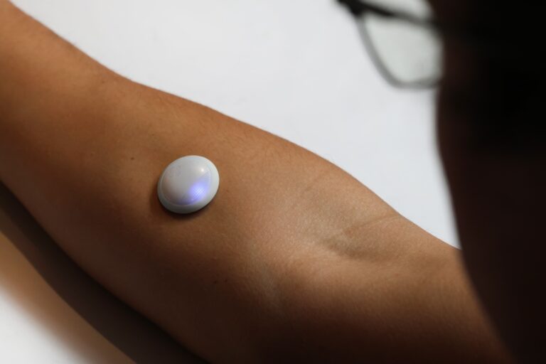 A person's arm faced up with a white glucose monitor on the forearm