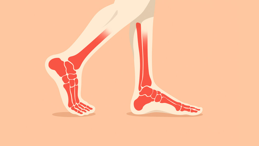 Graphic illustration of skeletal feet walking
