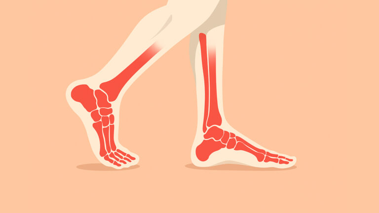 Graphic illustration of skeletal feet walking