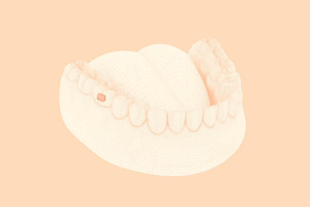Lura Health sensor on lower tooth