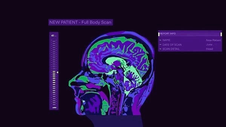 Graphic illustration of an MRI brain scan