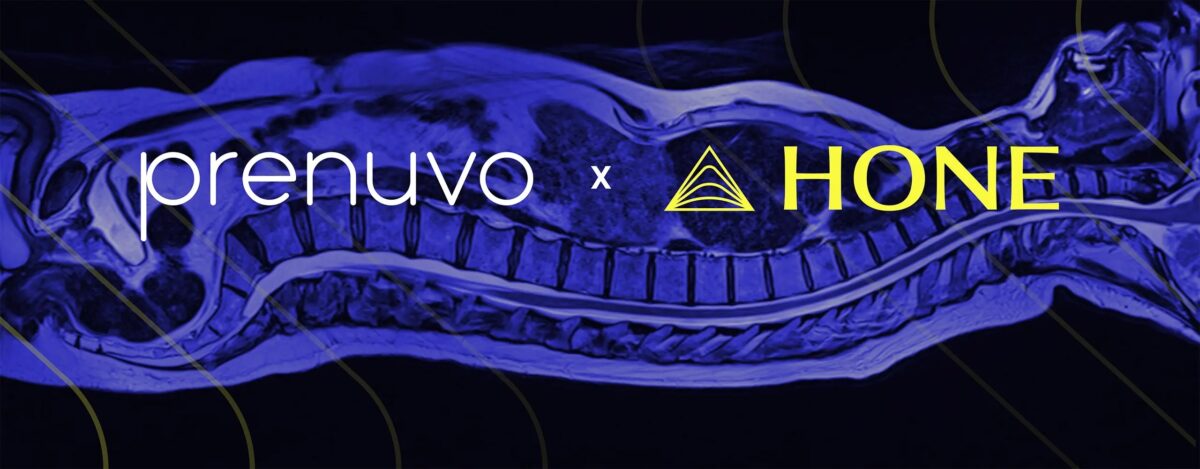 Prenuvo x Hone Health