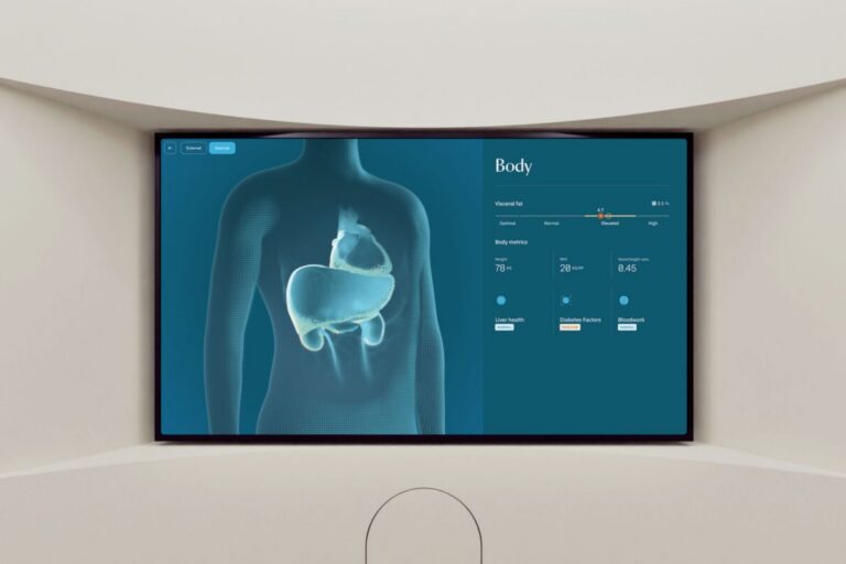 Neko health body scan