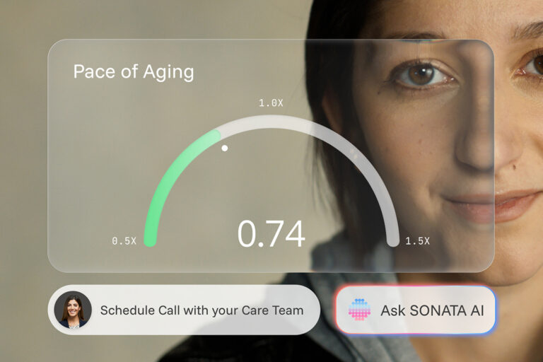 SONATA aging feature