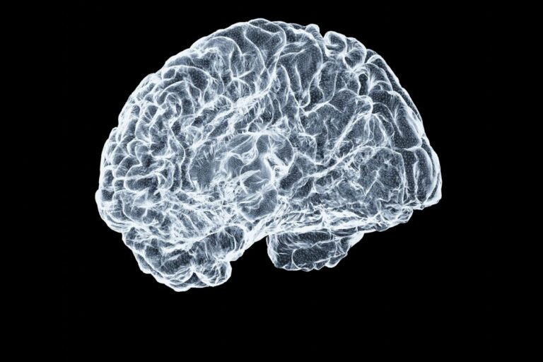 Brain imaging