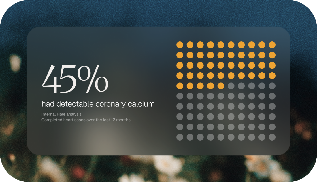 In an internal analysis of completed heart scans in the last 12 months, 45% showed detectable coronary calcium: a sign that calcified plaque had begun to develop.